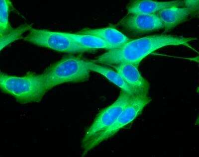 Immunocytochemistry/Immunofluorescence: Complement Component C1qA Antibody [FITC] [NB120-4223]